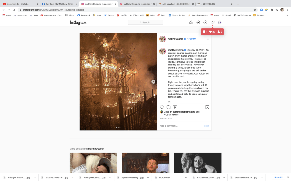Gay porn star MATTHEW CAMP survives vicious  arson attack
